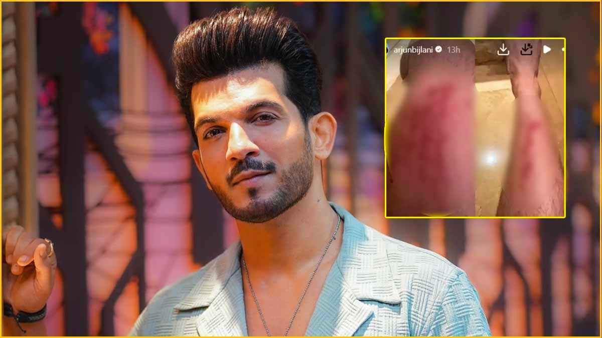 Arjun Bijlani का गोवा में हुआ एक्सीडेंट, 'नागिन' एक्टर ने शेयर की तस्वीर, देखते ही घबरा गए फैंस