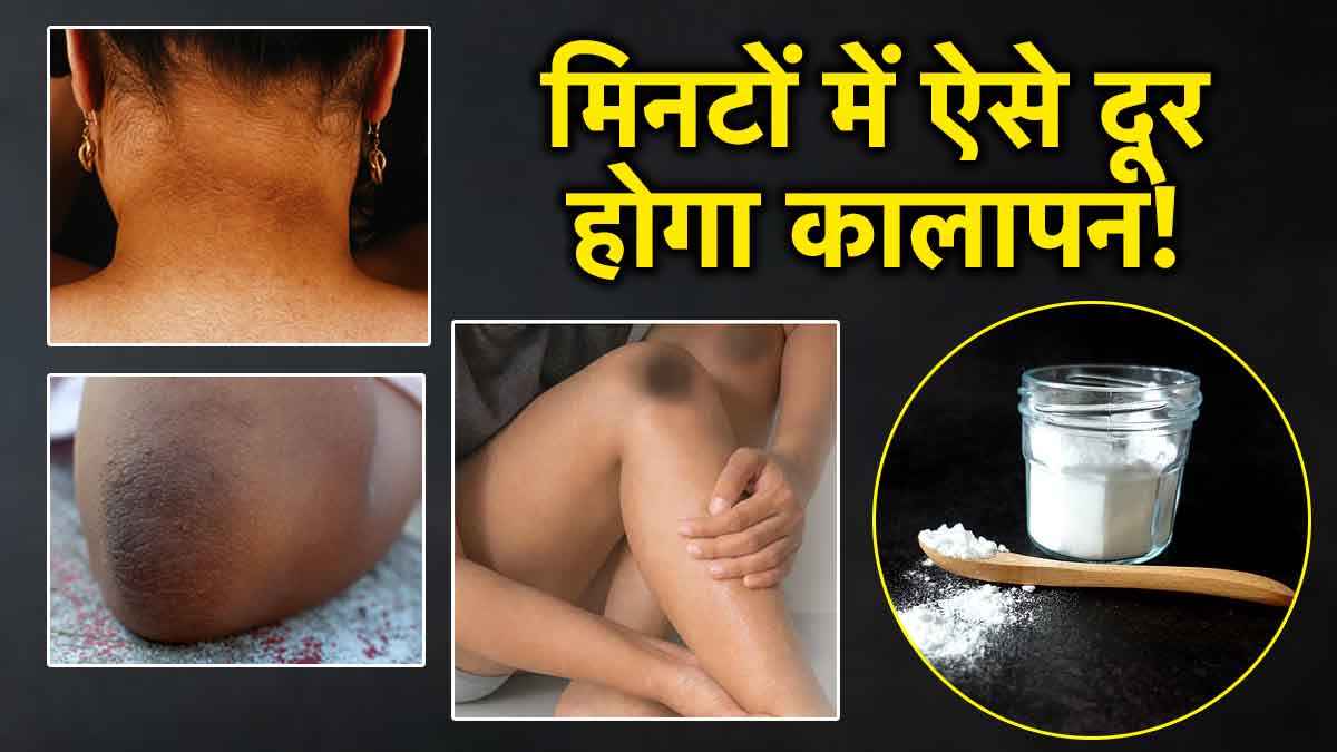 Beauty Hacks: सिर्फ 10 रुपये में दूर होगा गर्दन से लेकर कोहनी का कालापन!