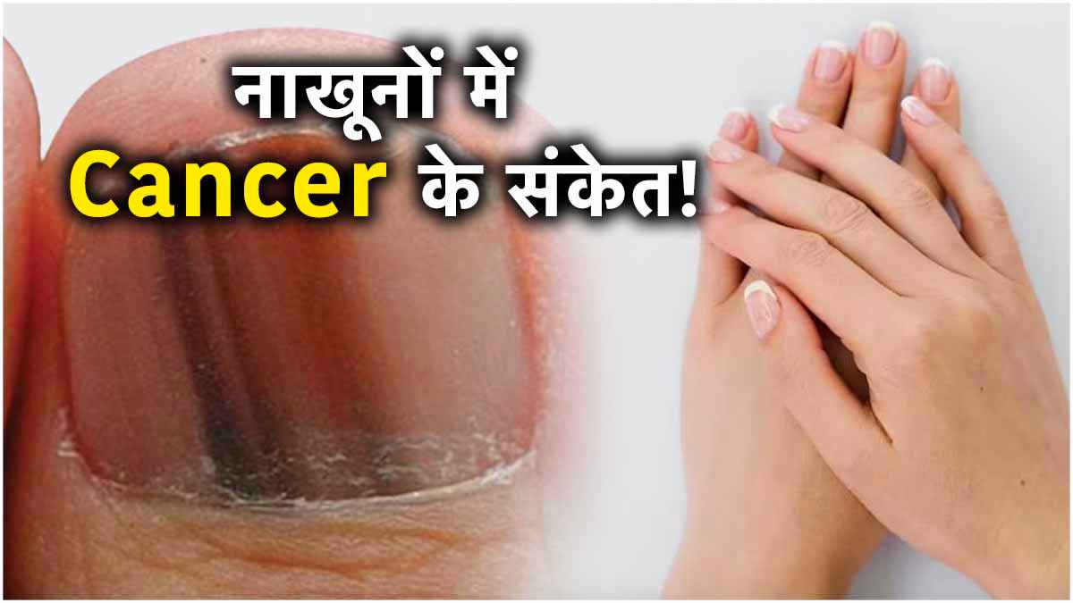 नाखून से भी मिलते हैं कैंसर के संकेत, रिसर्च में सामने आई ये बात