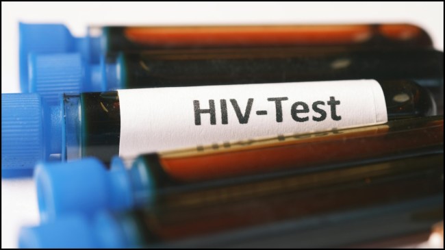 HIV Test