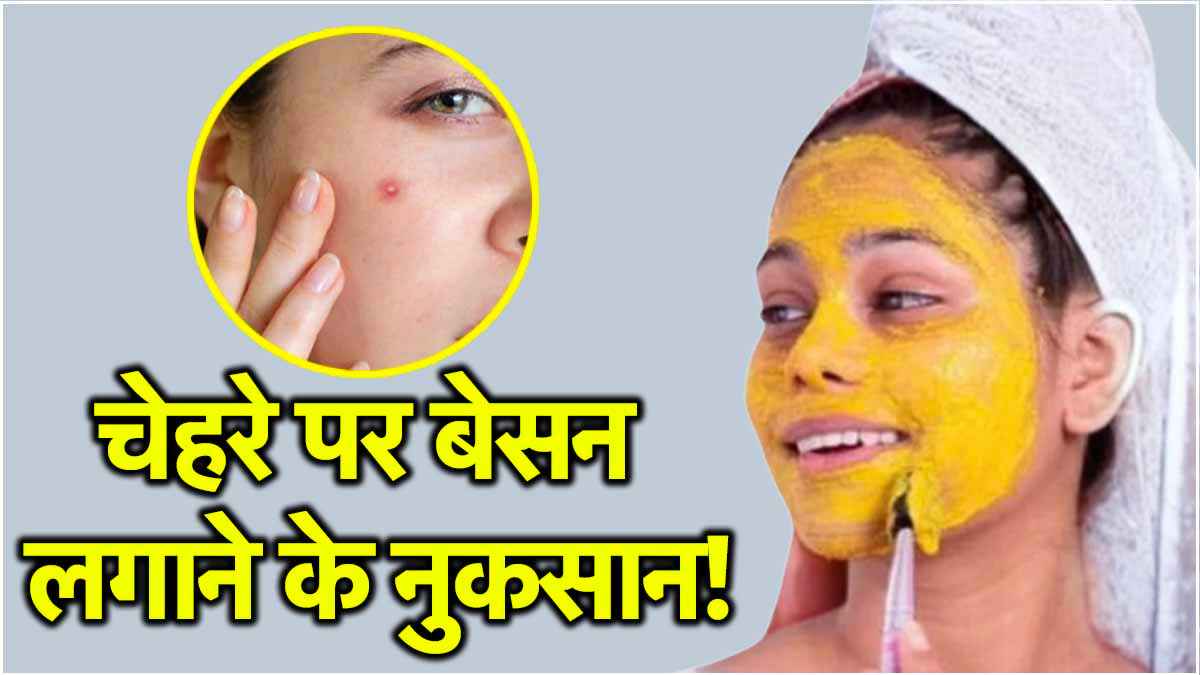 चेहरे पर बेसन लगाने के 4 साइड इफेक्ट, कहीं ग्लोइंग स्किन पर पिंपल्स न हो जाएं
