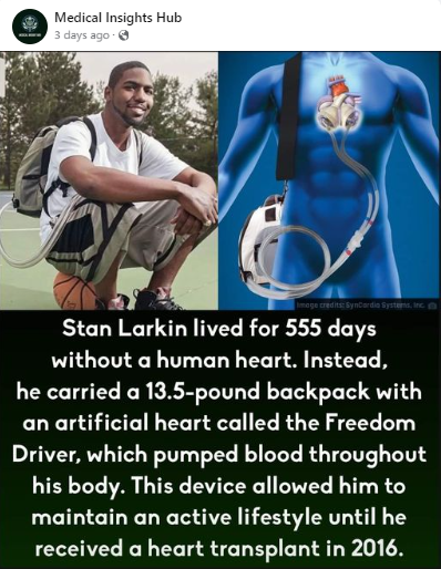 Stan Larkin Heart Transplant