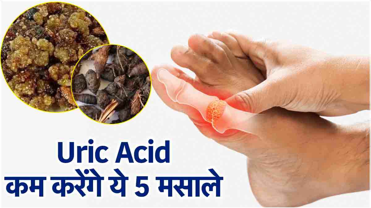 बढ़े हुए Uric Acid को जड़ से खत्म कर देंगी ये 5 जड़ी बूटियां, मिलेगा दर्द में आराम