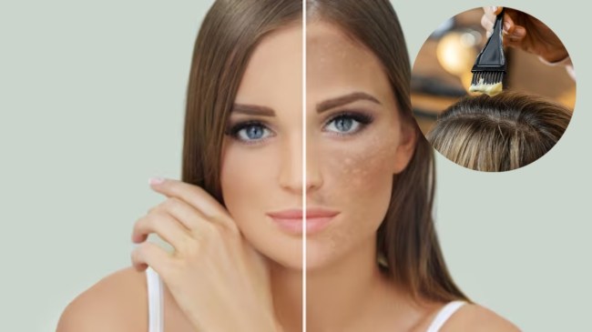 dark skin causes dark skin causes