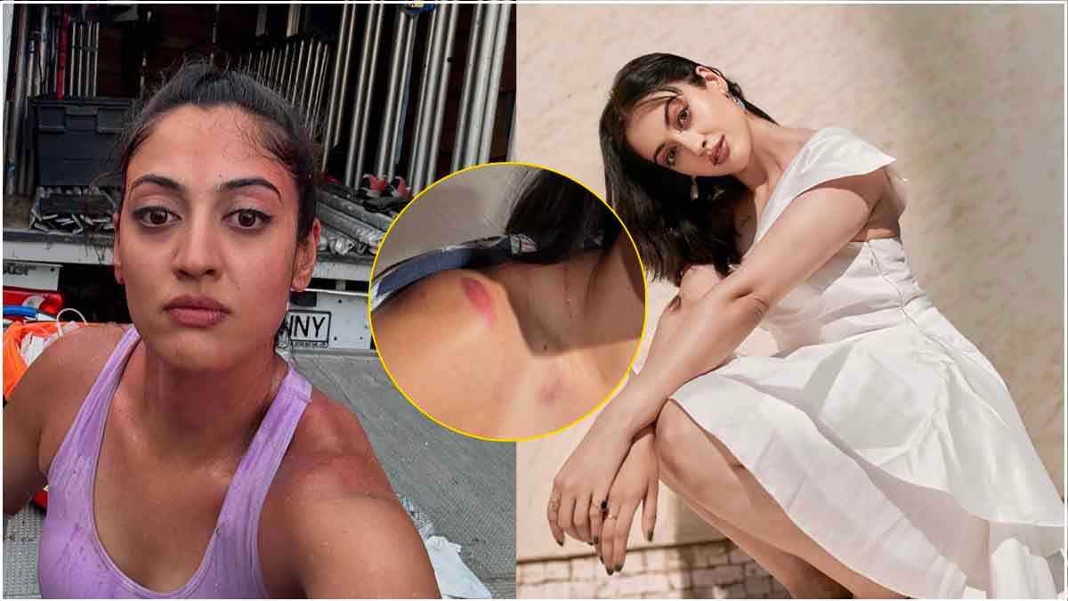 मशहूर टीवी एक्ट्रेस खतरनाक स्टंट करते हुए घायल, तस्वीरों में जख्म देख घबराए फैंस