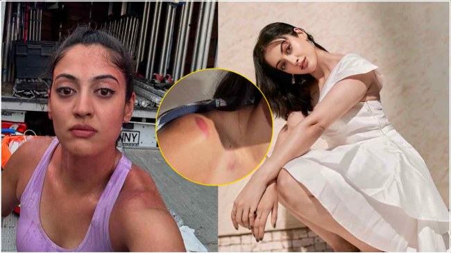 Aditi Sharma Injured