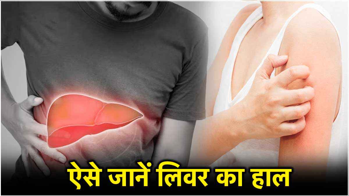 बॉडी में दिखने लगे ये संकेत तो समझ लें Liver देने वाला है धोखा, जान लें लिवर खराब होने के लक्षण