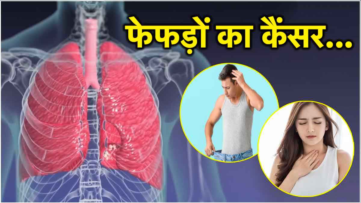 Lung Cancer Day: फेफड़ों के कैंसर के 7 संकेत को न करें इग्नोर; जानें लक्षण और बचाव