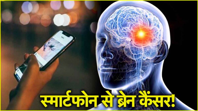 Cell Phone Radiation Side Effects on Human Body