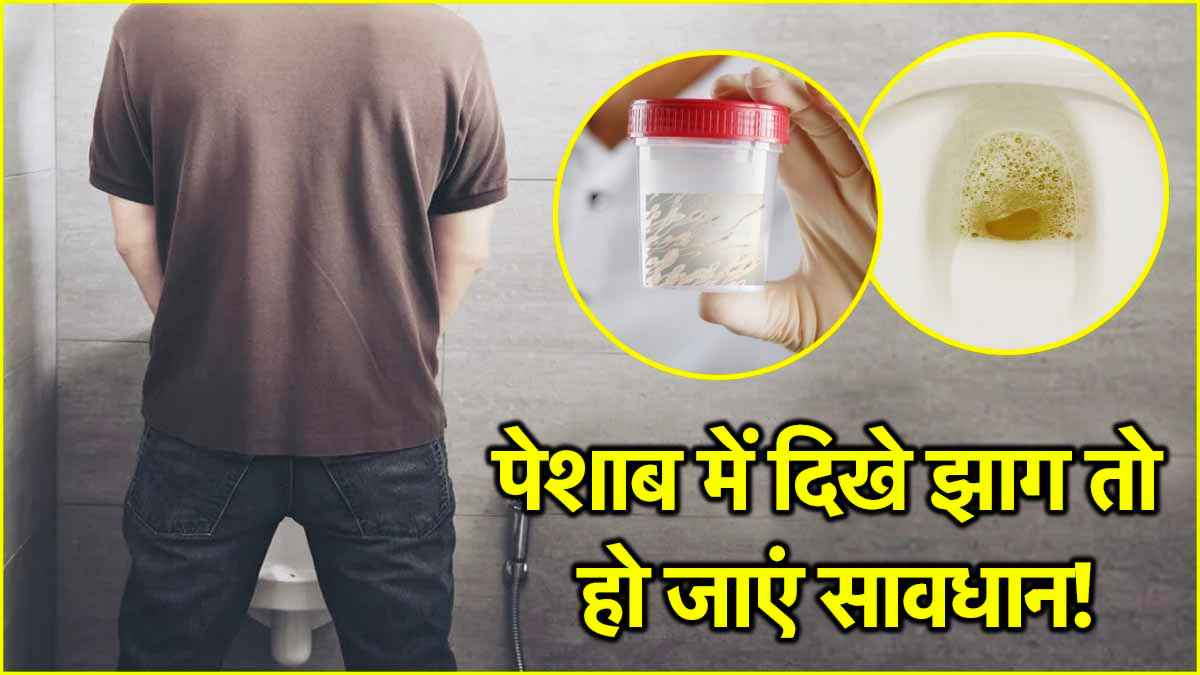 Bubbles in Urine: 99% पुरुष नहीं जानते पेशाब में झाग आने का कारण, ये है गंभीर समस्या का संकेत! 