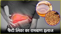 Fatty Liver Problem Home Remedies