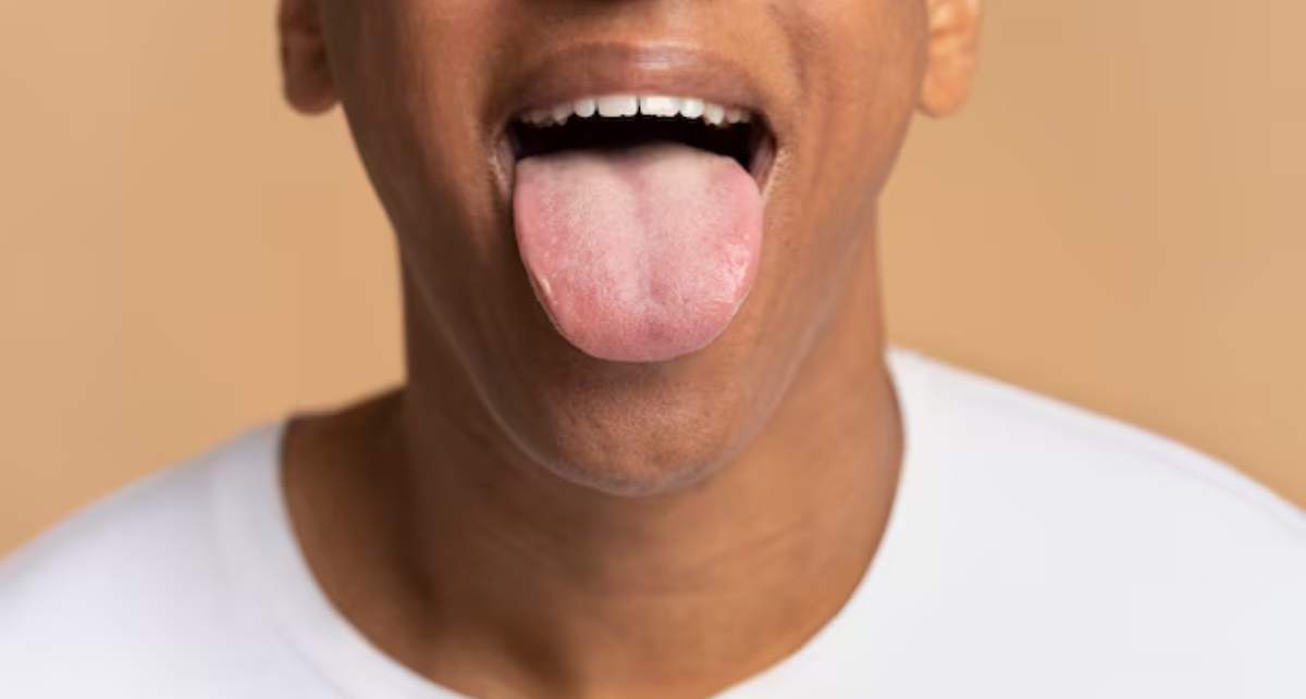 Tongue Colour