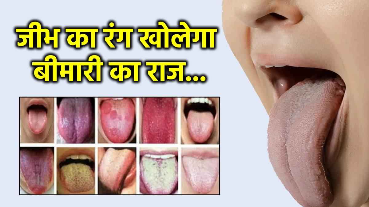 Tongue Colour
