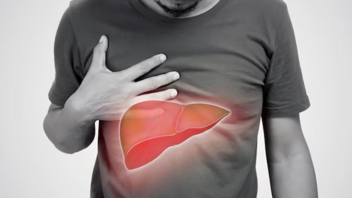 fatty liver signs