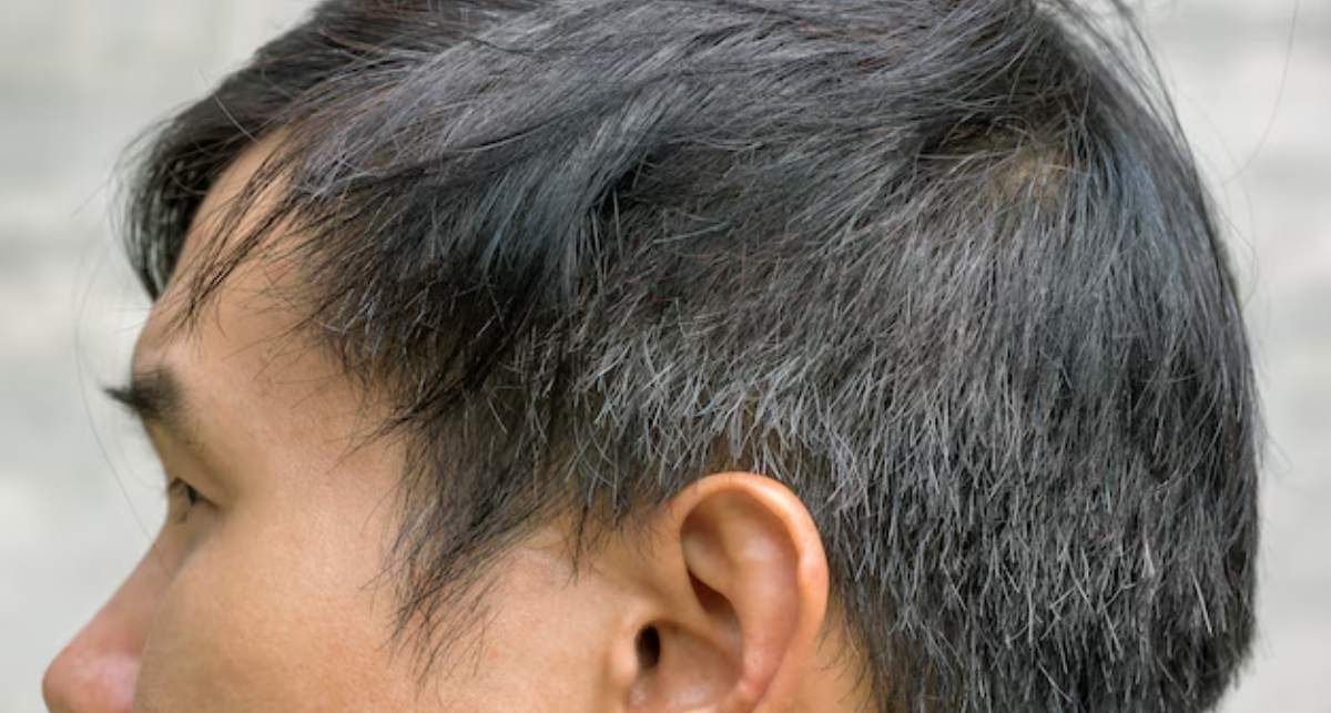 grey hairs problem