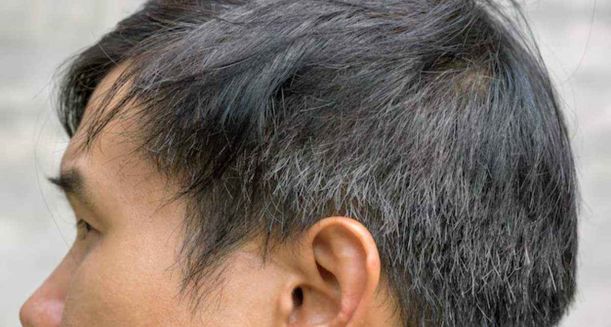 इन 5 कारणों के चलते समय से पहले सफेद हो जाते हैं बाल, ये नुस्खे आएंगे काम