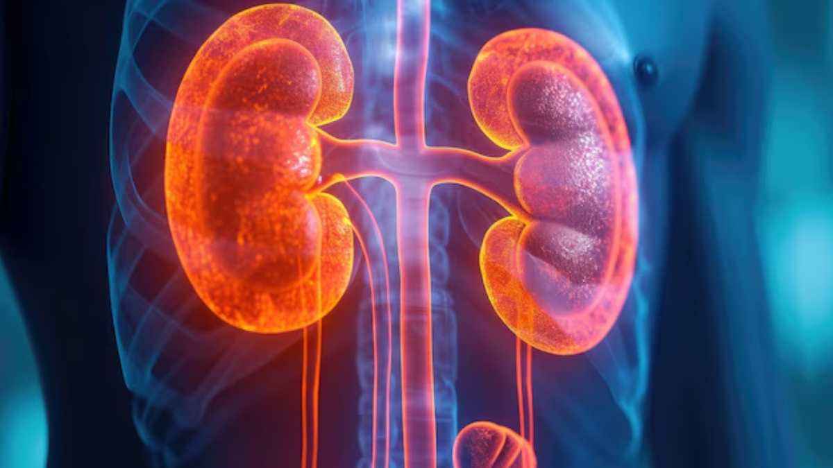 क्या वजन घटाने के लिए की गई सर्जरी से कम होता है किडनी फेलियर का खतरा? स्टडी में हुआ खुलासा