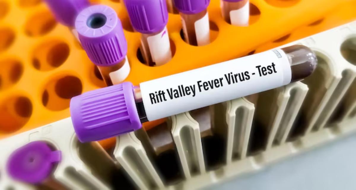 valley fever symptoms