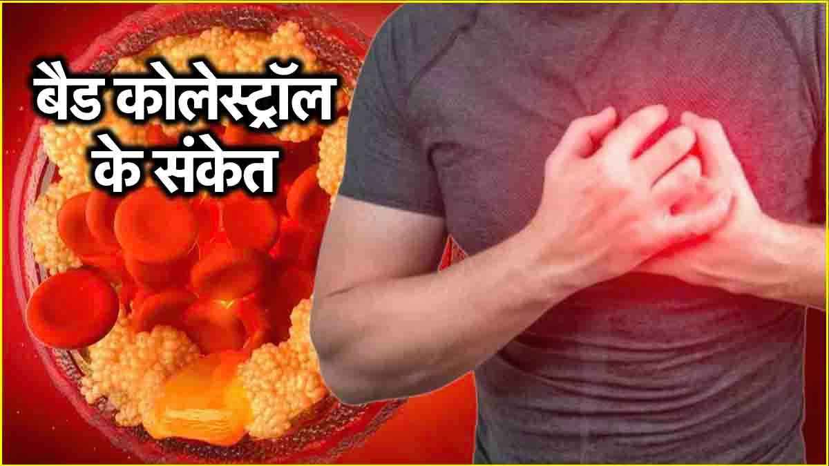 Bad Cholesterol Signs