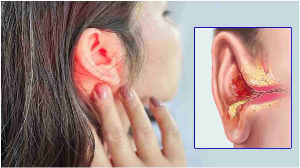 Ear Infection