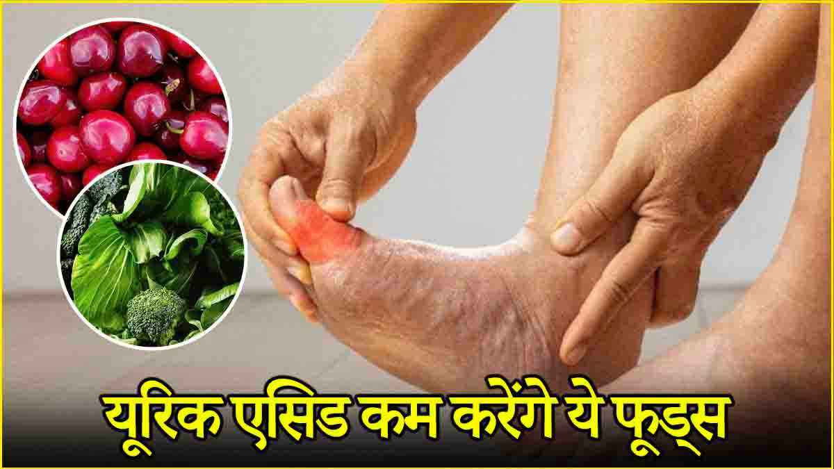 Foods For Uric Acid
