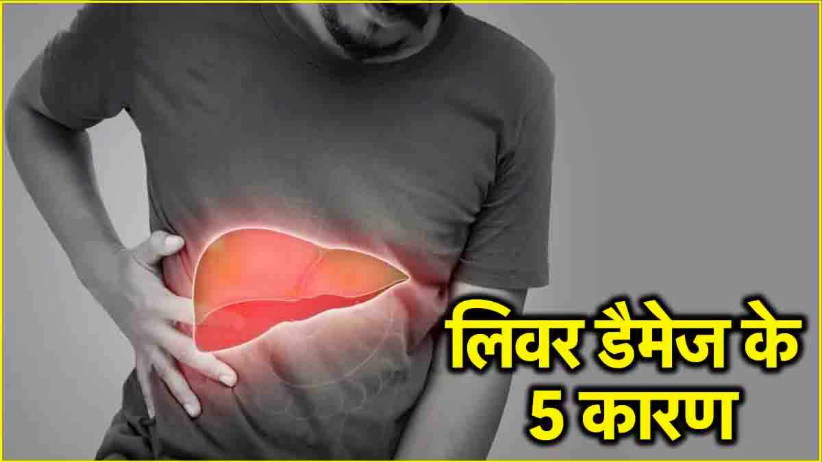 Liver Damage Causes