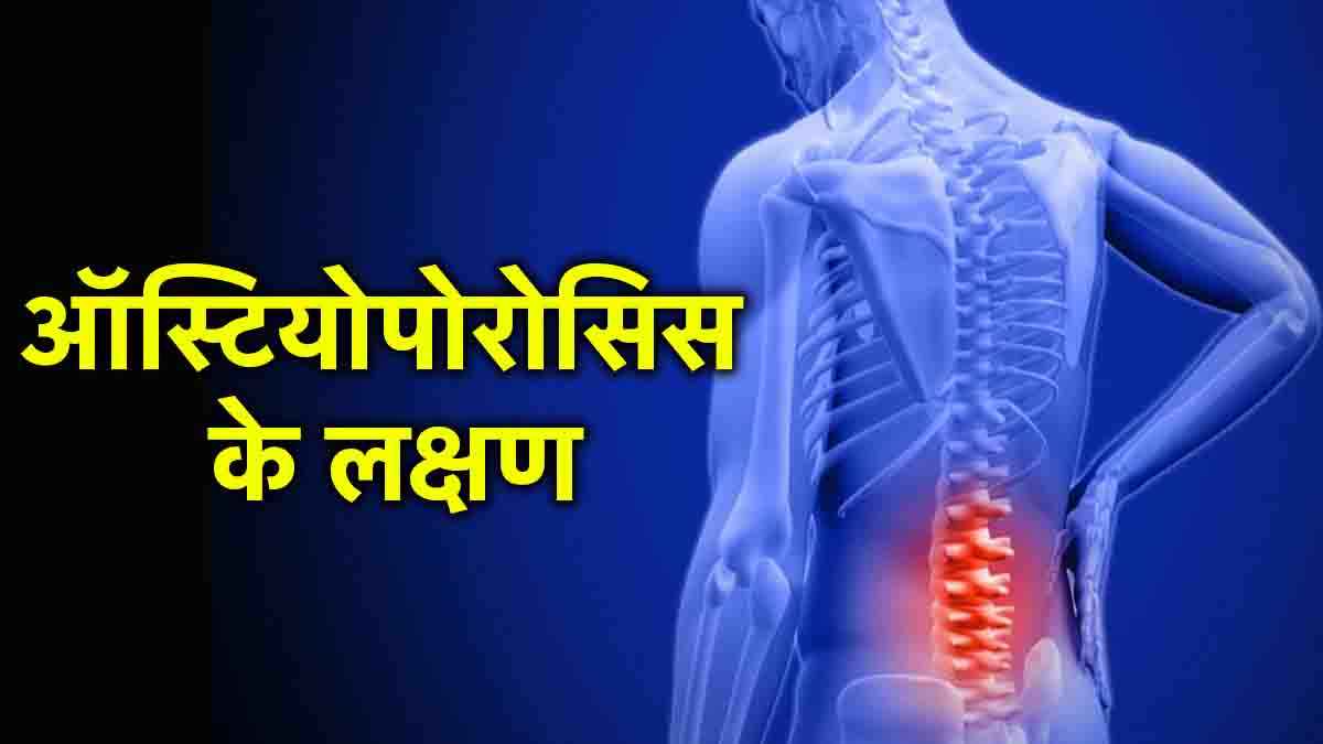 Osteoporosis Symptoms: ऑस्टियोपोरोसिस के 5 संकेत देखते ही जाएं डॉक्टर के पास, जाने कैसे करें पहचान?