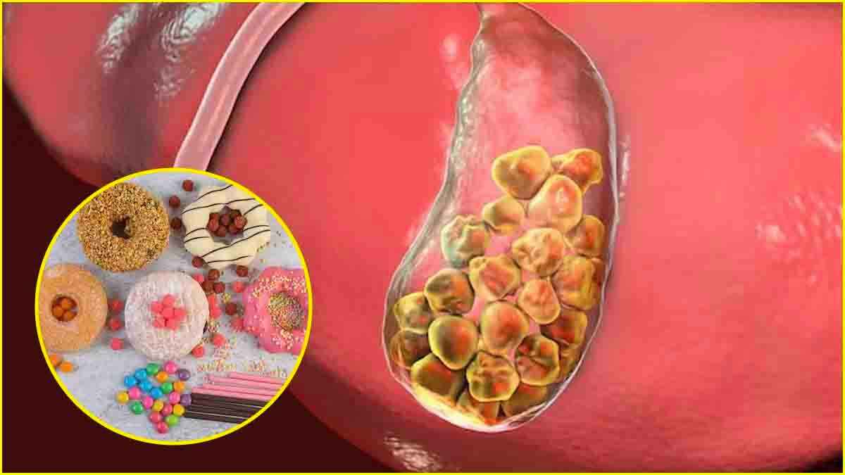 Stones Causing Food: ब्रेड समेत इन 5 चीजों से होती है पथरी! आज से ही बना लें दूरी