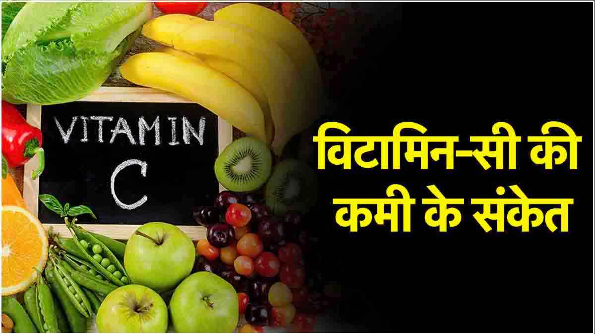 थकान-सूजन समेत इन 7 संकेतों को अनदेखा करना पड़ सकता है भारी! विटामिन-C की कमी है वजह