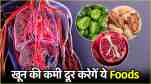 Iron Deficiency Anemia