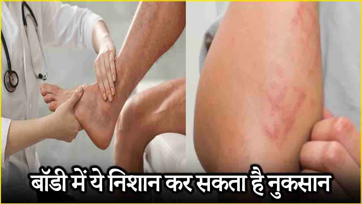 Health Tips Health Tips
