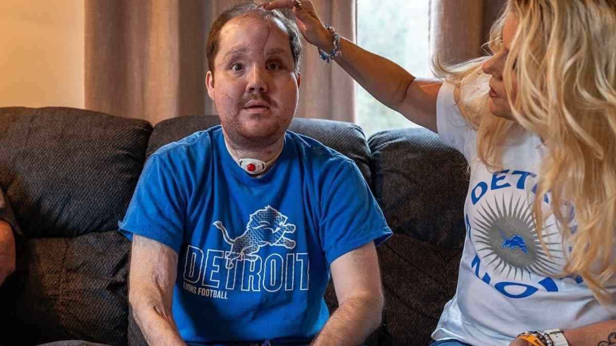 US Man Receives Successful Face Transplant