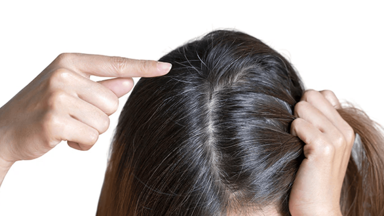 Hair Care Tips: 15 दिन में जड़ से काले होंगे सफेद बाल, अपनाएं ये आसान तरीके