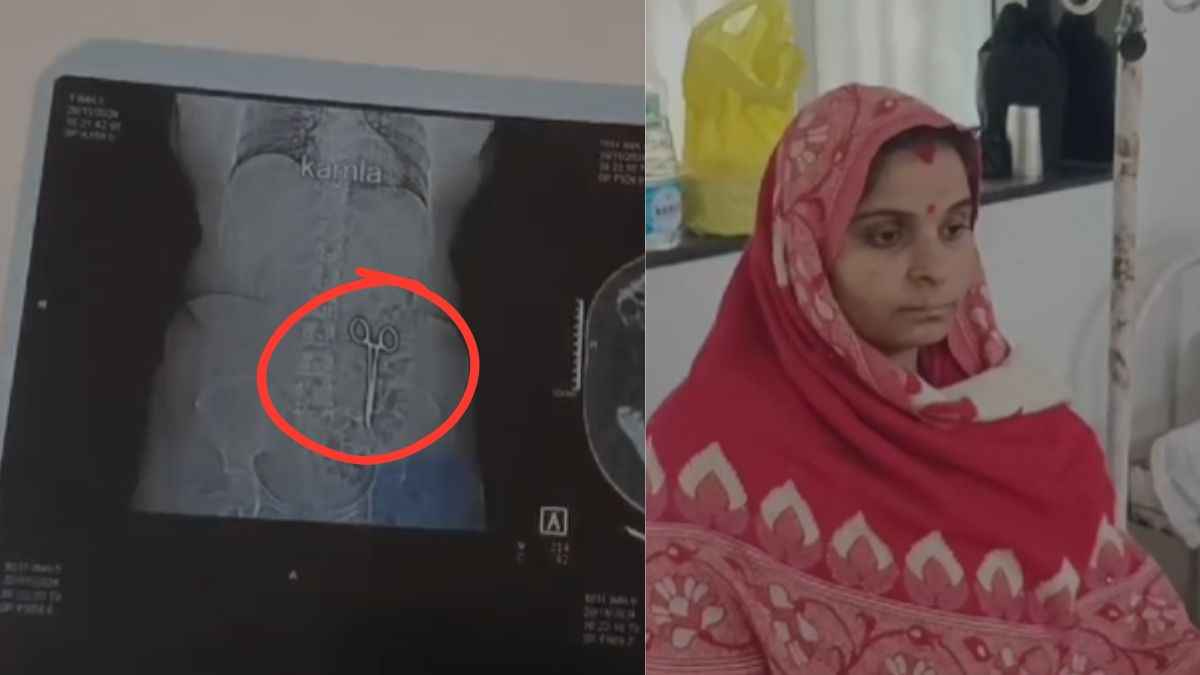 पेट दर्द पर जब कराया सीटी स्कैन तो महिला के उड़े होश, दो साल पहले की डॉक्टरों की चूक का खुलासा