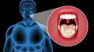 mouth cancer causes