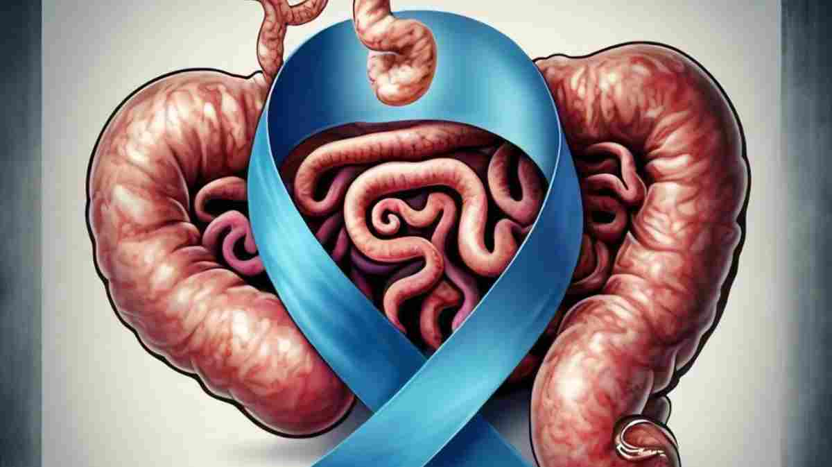 Colon Cancer Signs