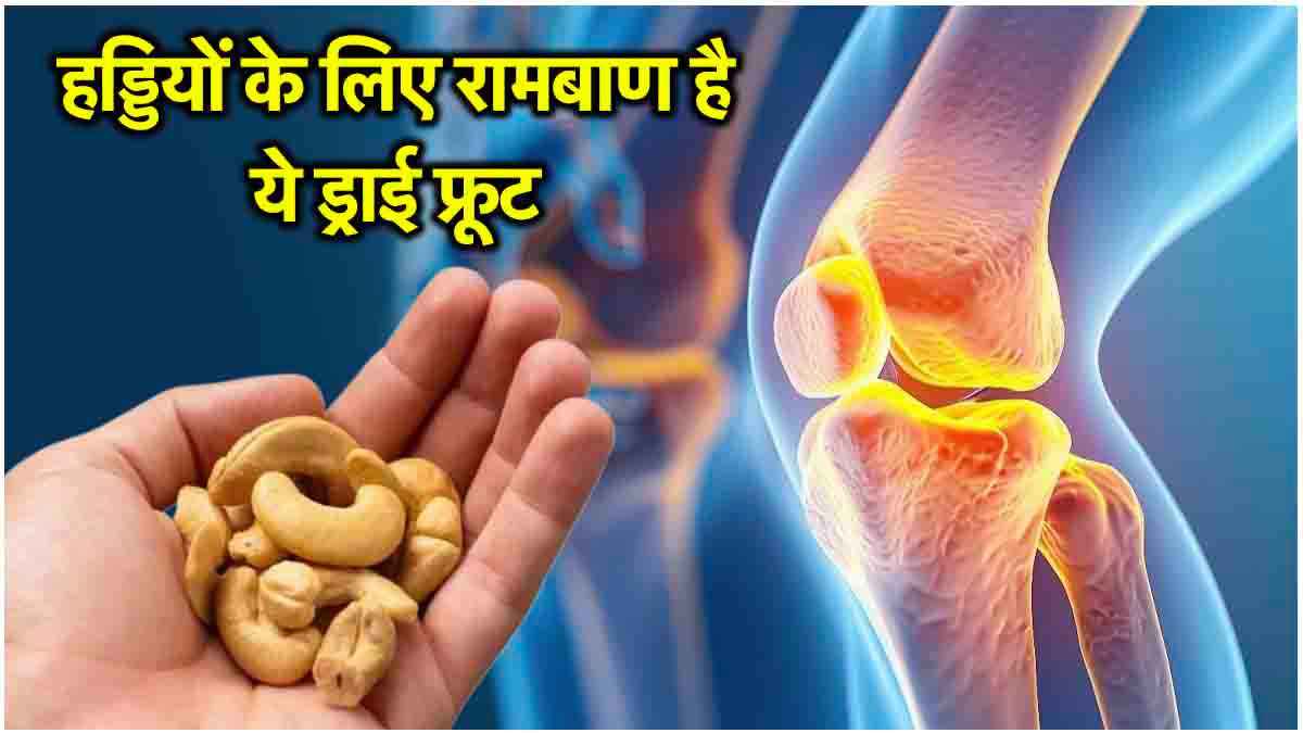 Cashew Benefits: कमजोर हड्डियां भी होंगी मजबूत, इन 5 तरीकों से करें काजू का सेवन