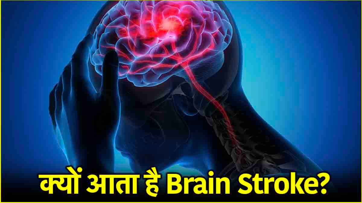 Brain Stroke Causes: सर्दियों में ये 5 संकेत ब्रेन स्ट्रोक के लक्ष्ण, क्या कहते हैं डाक्टर?
