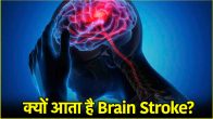 Brain Stroke Causes