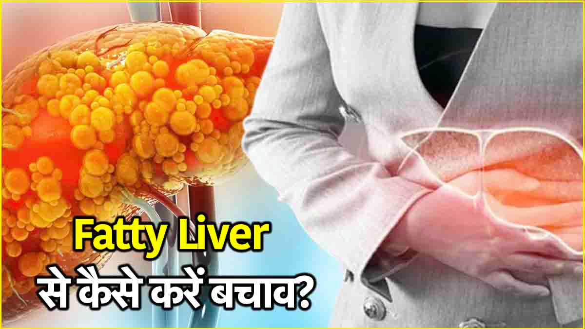 Fatty Liver