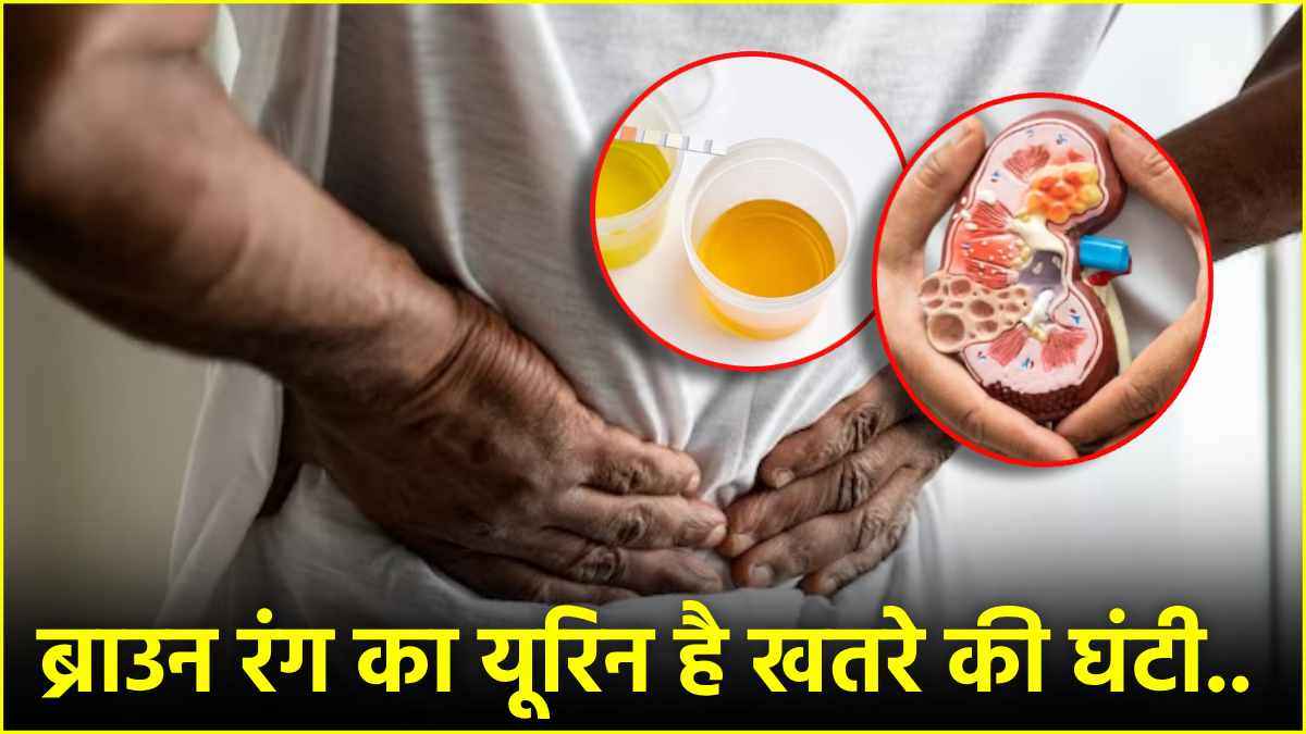 Kidney Failure Signs: ये 7 संकेत बताएंगे फेल होने वाली है किडनी