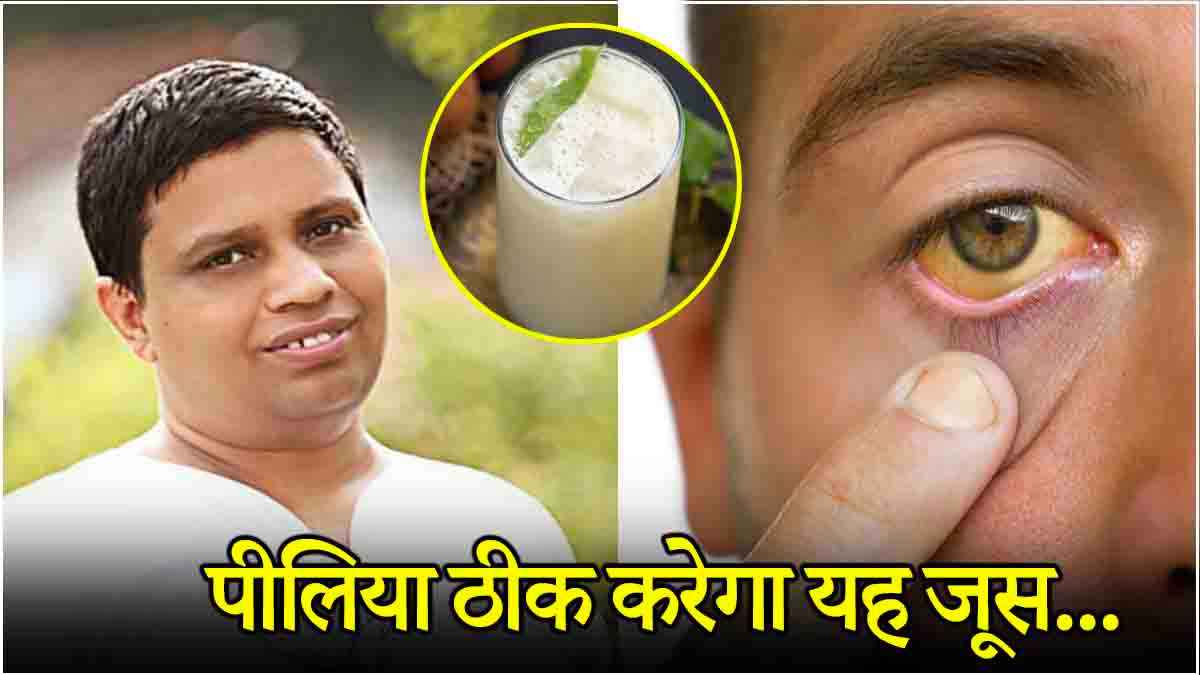 घरेलू तरीके से ऐसे ठीक करें पीलिया! आचार्य बालकृष्ण ने बताया जबरदस्त उपाय