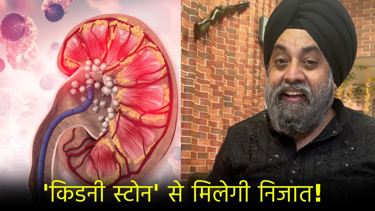 Kidney Stone Water Intake Manmeet Singh