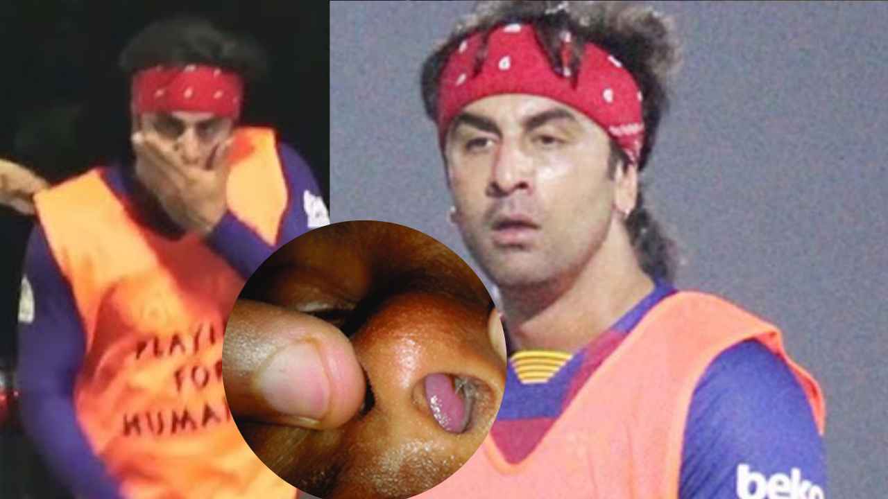 Nasal Septum क्या? जिस बीमारी से जूझ रहे Ranbir Kapoor, क्या है इसका रामबाण इलाज?