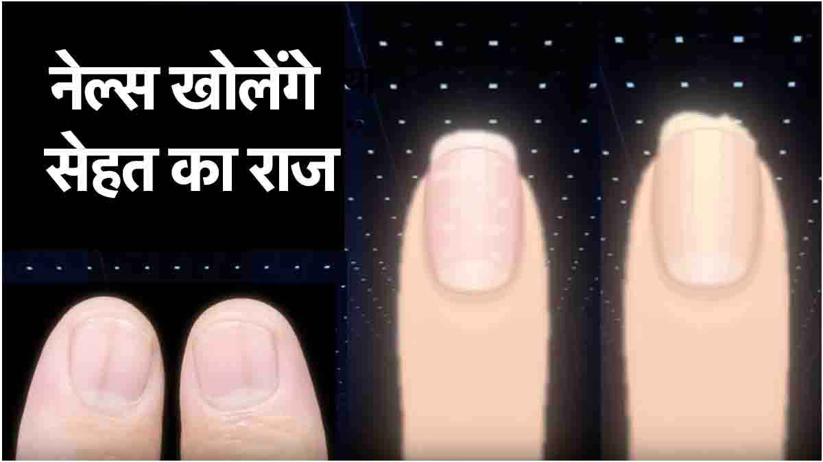 Nail Signs: नाखून में दिखने वाले ये 7 संकेत गंभीर बीमारी का इशारा, नजरअंदाज करना पड़ेगा भारी
