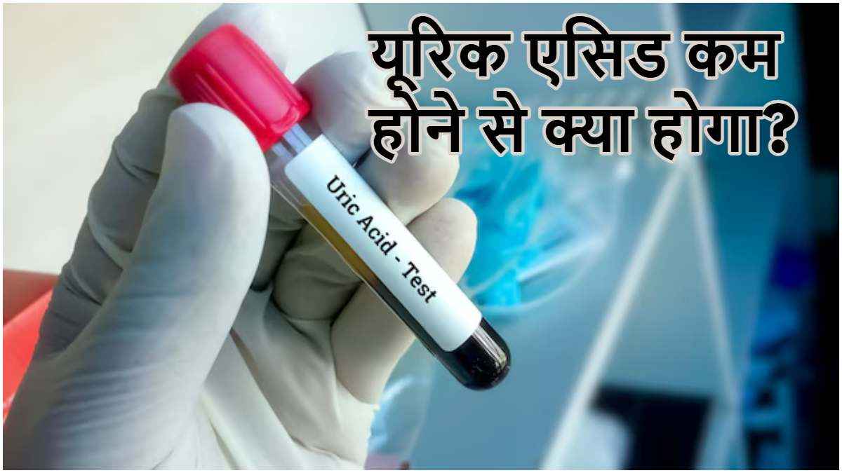 Uric Acid कम होना भी सेहत के लिए खतरनाक, बॉडी में दिखते हैं ये 5 संकेत