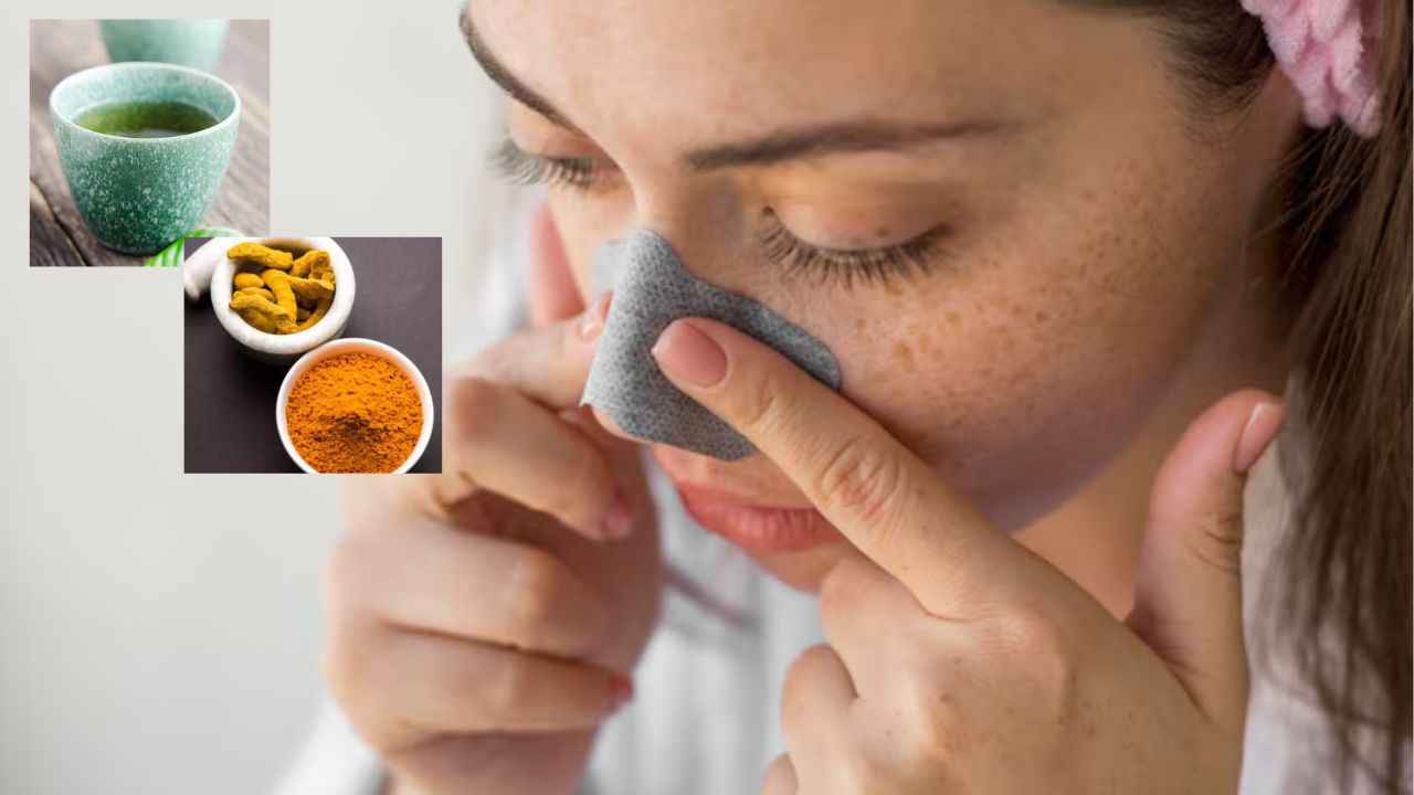 Skin Care Tips: नाक के ब्लैकहेड्स हटाने के लिए अपनाएं ये 3 घरेलू उपाय, हमेशा-हमेशा के लिए खत्म होगी ये समस्या
