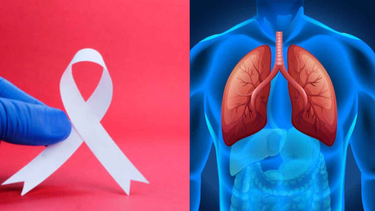 Lungs Cancer: पेशाब से पता चलेगा फेफड़ों का कैंसर है या नहीं? रिसर्च में हुआ खुलासा