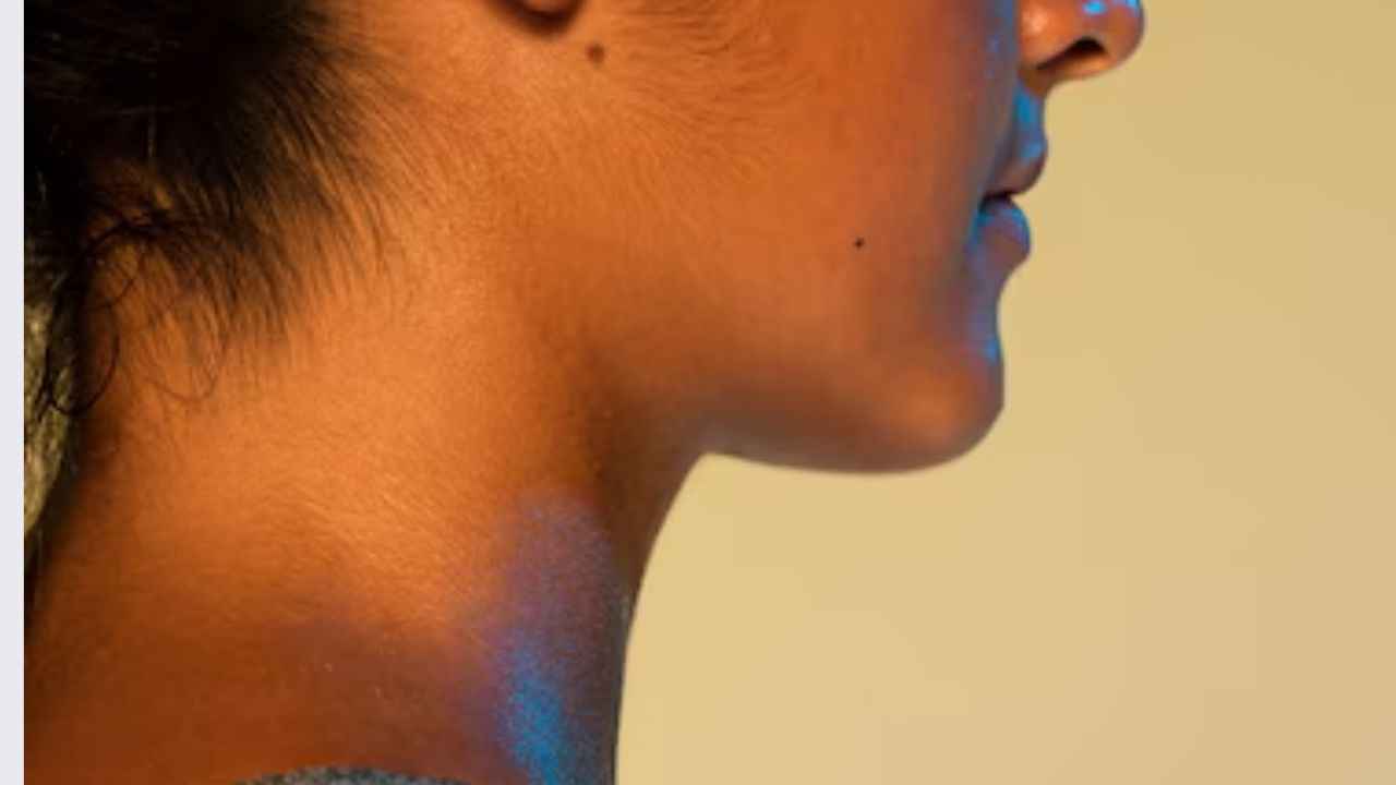 Blackish Behind Neck: आपकी गर्दन देती है लिवर के कमजोर होने का संकेत, जानें क्या कहते हैं डॉक्टर  