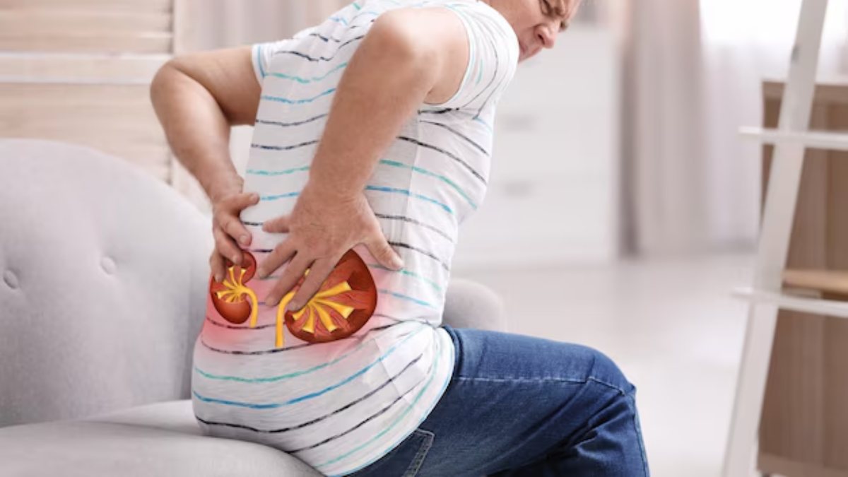 kidney stone causes